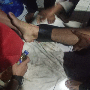Sandal Baru Nyangkut di Betis, Damkar Cicalengka Turun Tangan